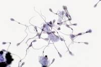 Spermatozoïdes de Taureau x200